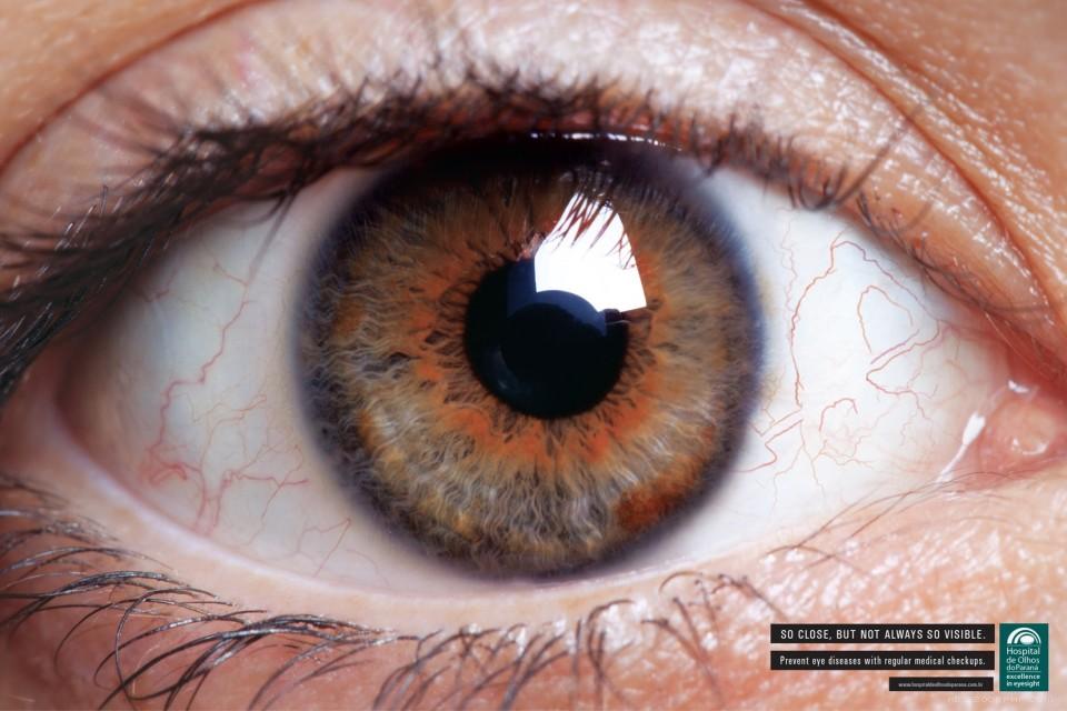 定期体检,预防眼疾-Hospital de Olhos do Paran