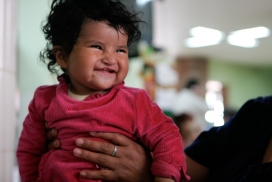 印度尼西亚Operation Smile 儿童唇腭裂微笑关怀行动摄影