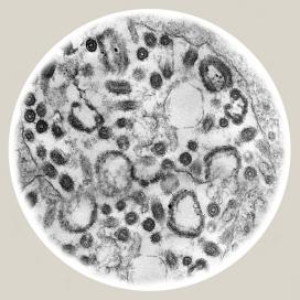 欧美Pestilence：瘟疫细菌图片