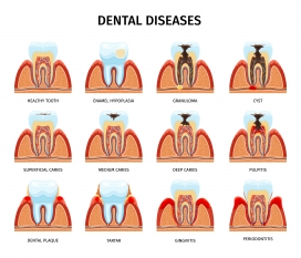 卡通牙齿牙龈解剖素材下载